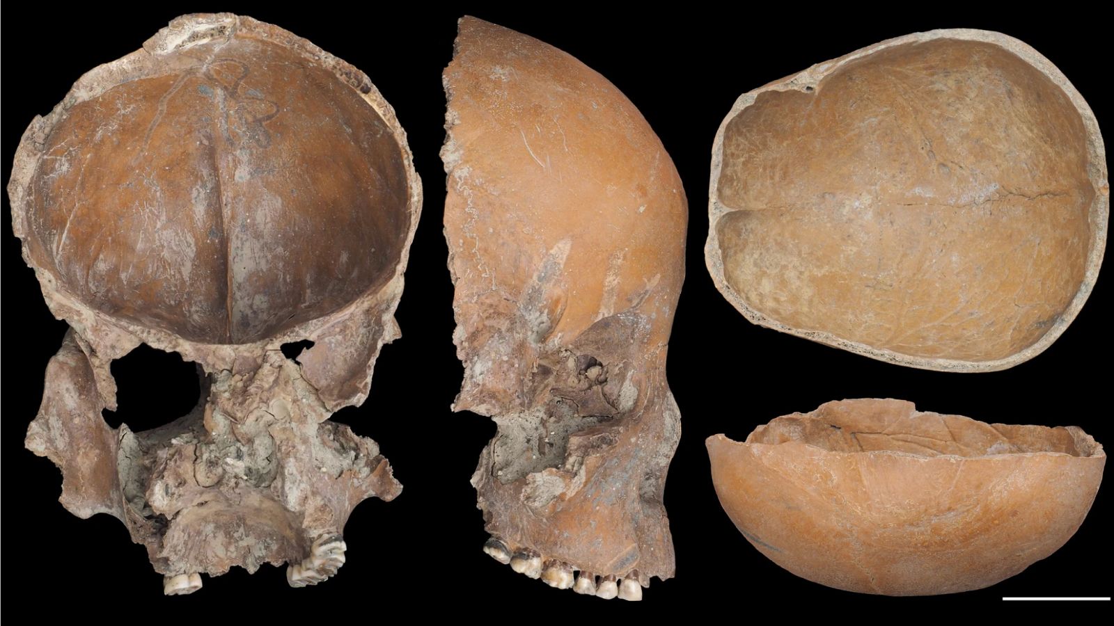 www.livescience.com
