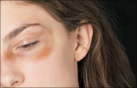 COV_BeatUp(5).jpg