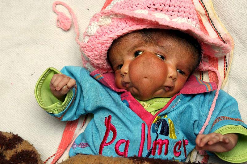 baby5MOS1503_800x534.jpg
