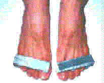 footbrac.jpg