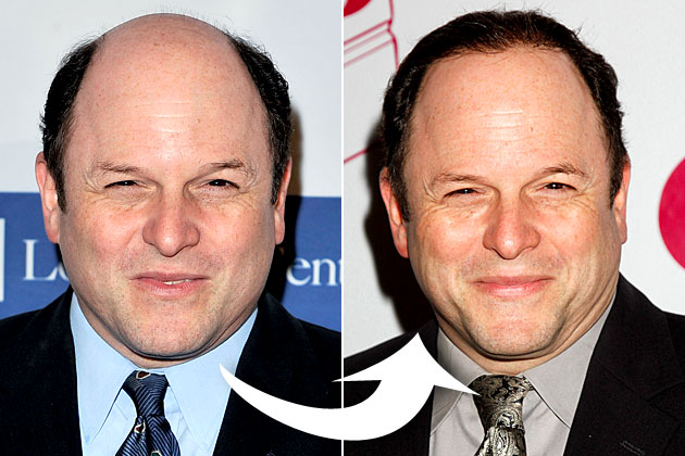 jason-alexander-hair.jpg