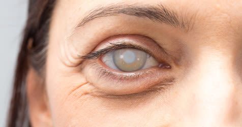 cataract-surgery-complications-1200x630.jpg_h_250